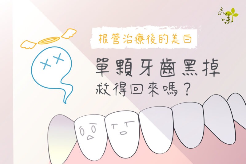 根管治療齒內美白