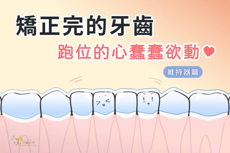 牙齒矯正後維持器要戴多久才不會跑位？