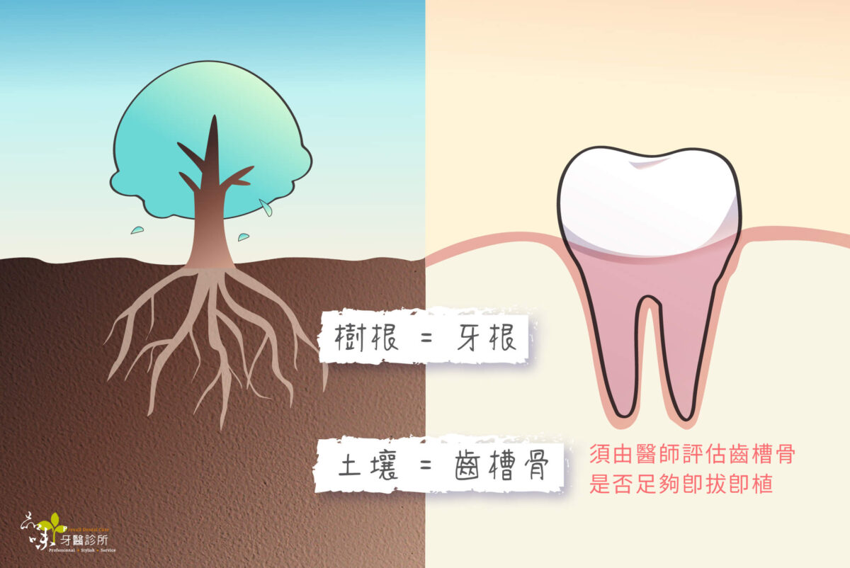 齒槽骨就像是土壤