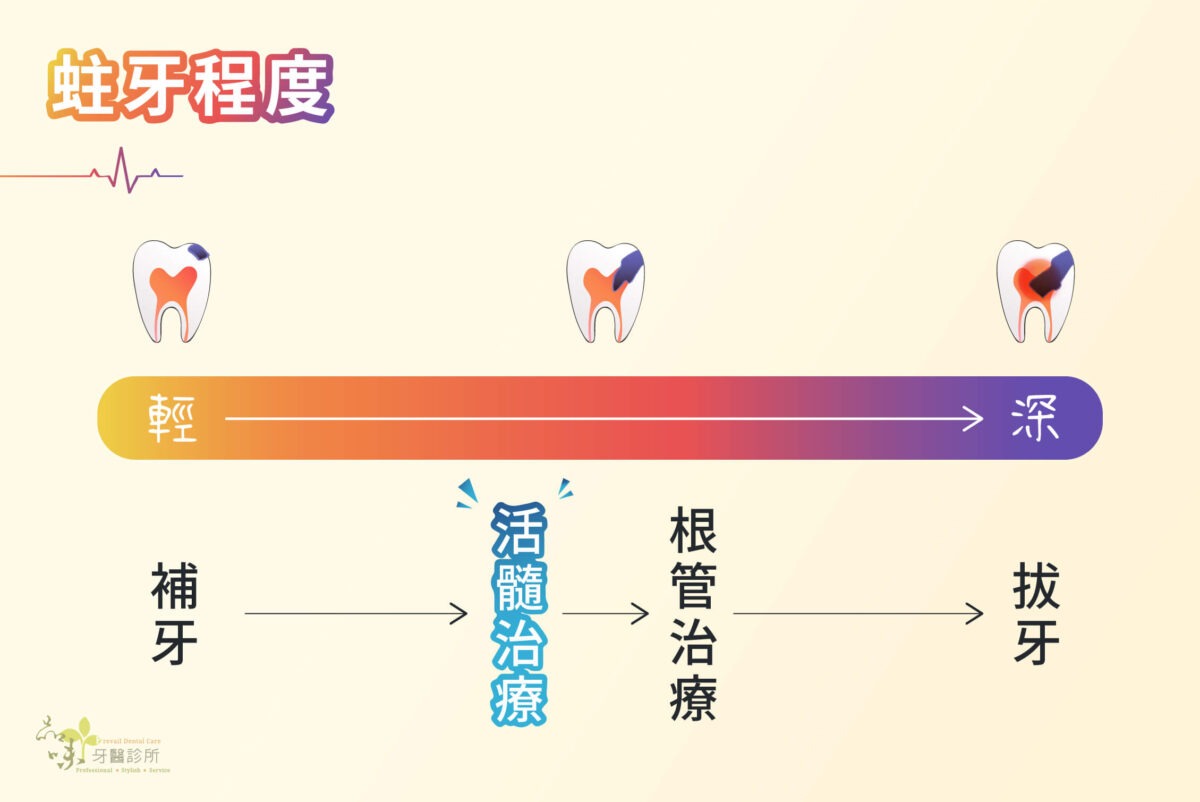 蛀牙進程圖與適合的治療方式