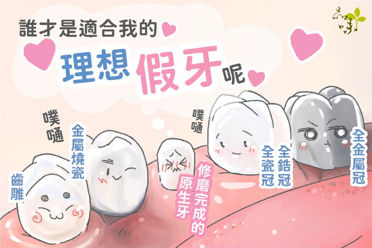 誰才是適合我的理想假牙