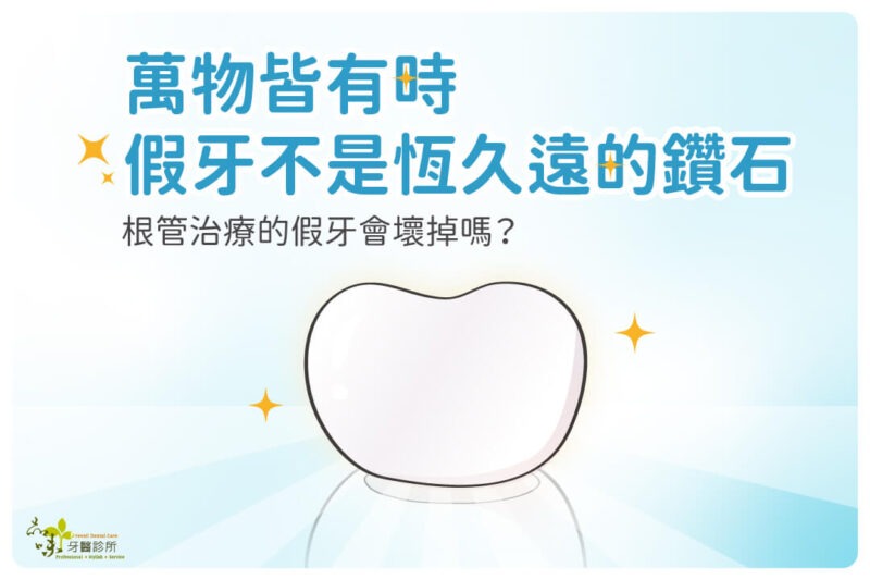 根管治療的假牙會壞掉嗎？萬物皆有時，假牙不是恆久遠的鑽石