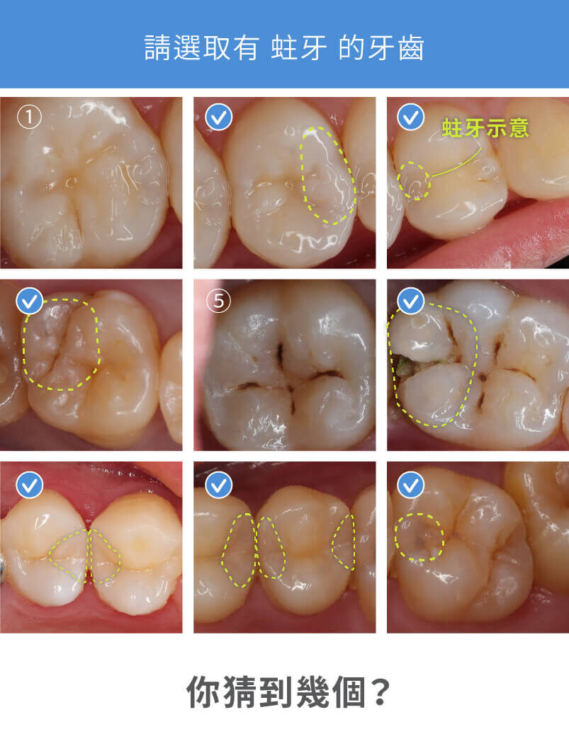 牙齒蛀牙猜謎九宮格解答有六個牙齒蛀牙