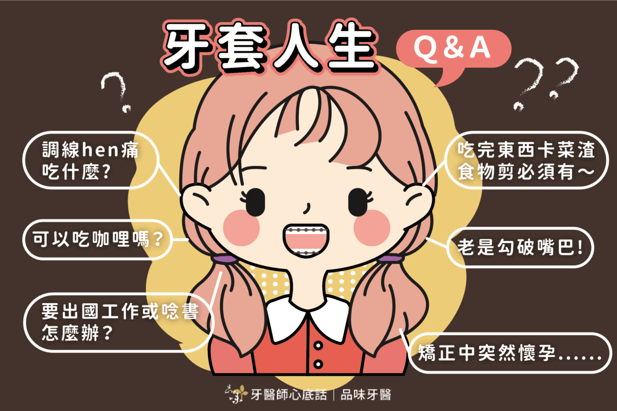 矯正牙齒的牙套人生小煩惱