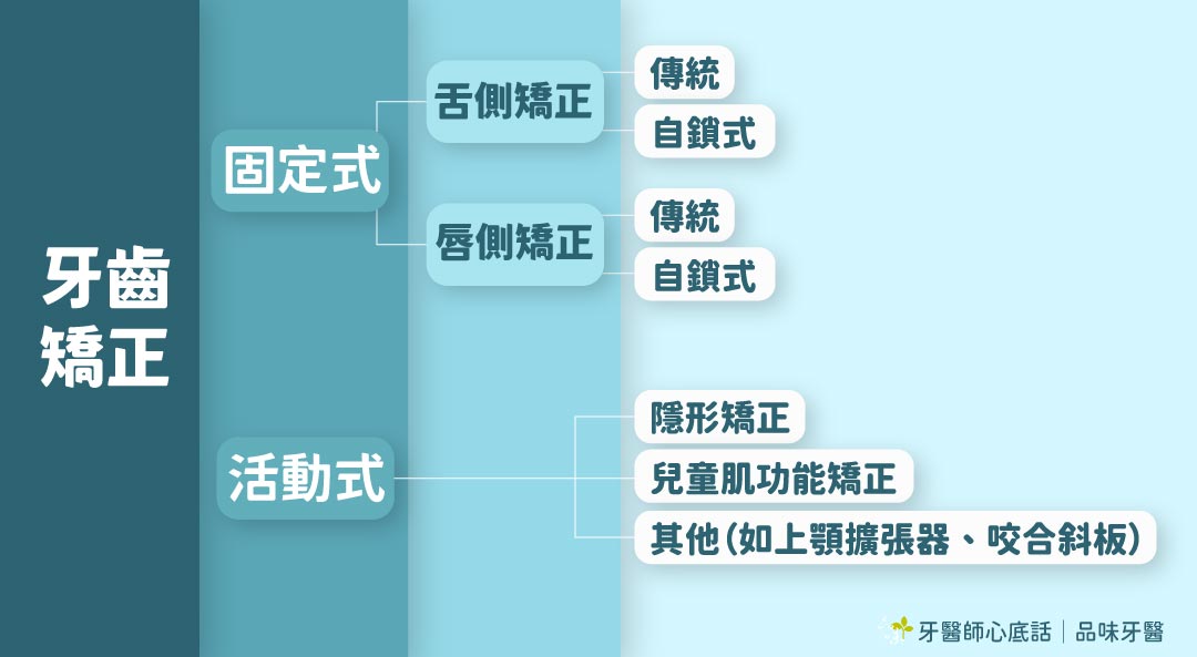 牙齒矯正可分為固定式與活動式:其中固定式矯正又可分為舌側與唇側矯正,活動式矯正最知名的就是隱形矯正。