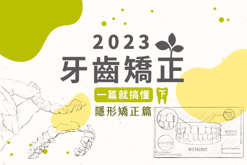 隱形矯正就是隱適美？價格這麼貴，要怎麼挑？