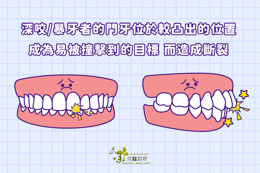 深咬 暴牙者的門牙位於較凸出的位置
成為易被撞擊到的目標 而造成斷裂。