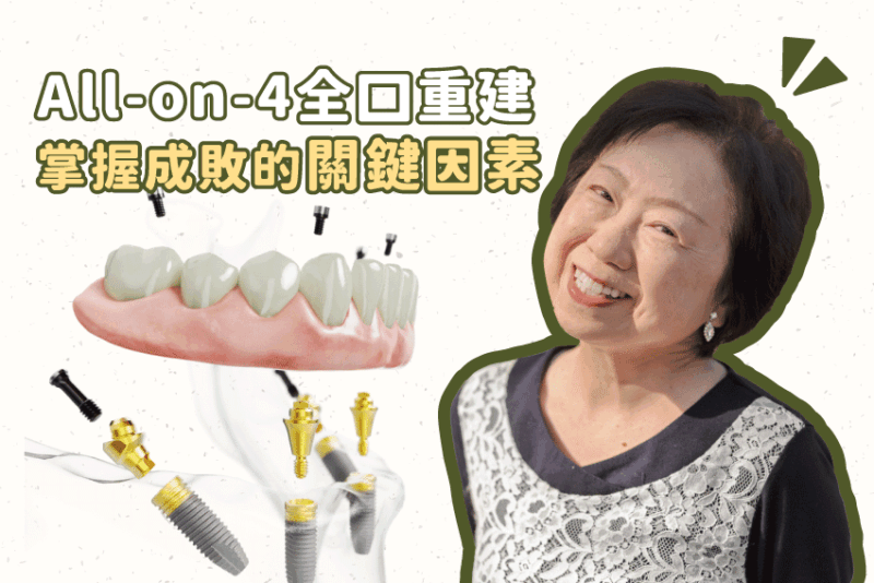 All-on-4全口重建可能失敗嗎？掌握成敗的關鍵因素