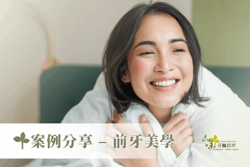 案例分享 – 前牙美學