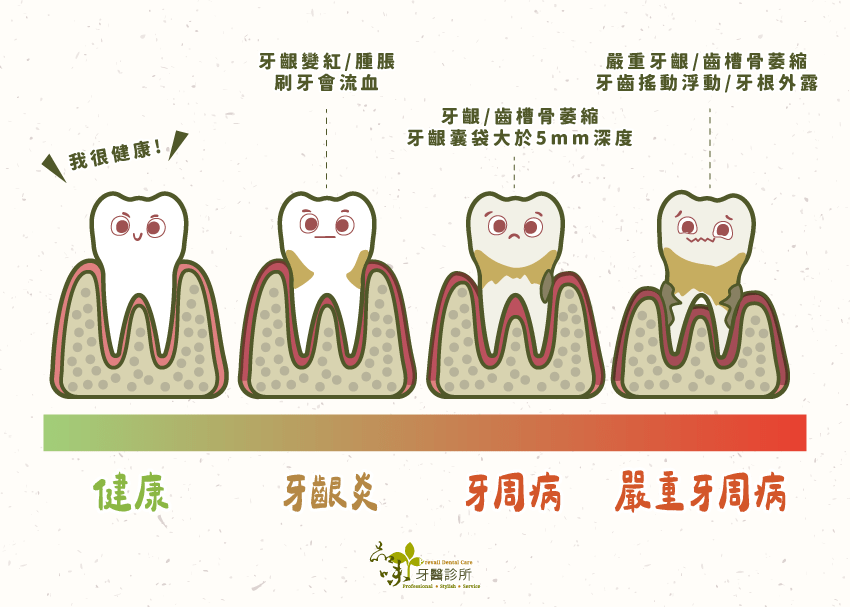 牙周病各個階段會出現的症狀
