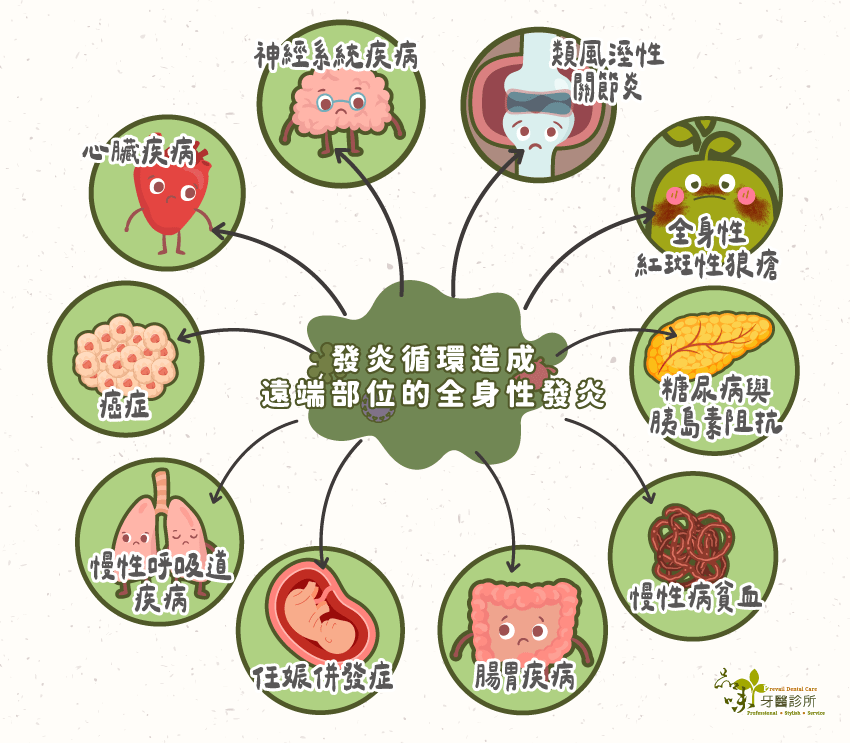 身體的發炎循環會造成遠端部位多種全身性發炎疾病