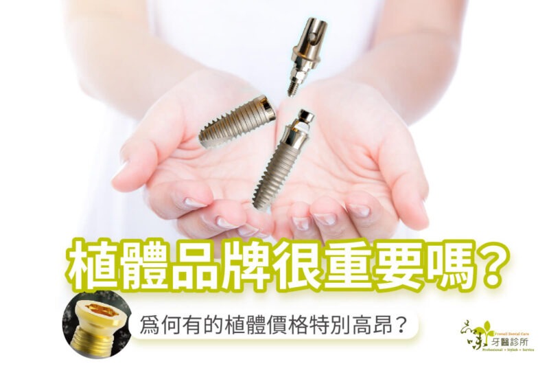 【品味牙醫】為何有的植體價格特別高昂？植體品牌很重要嗎？