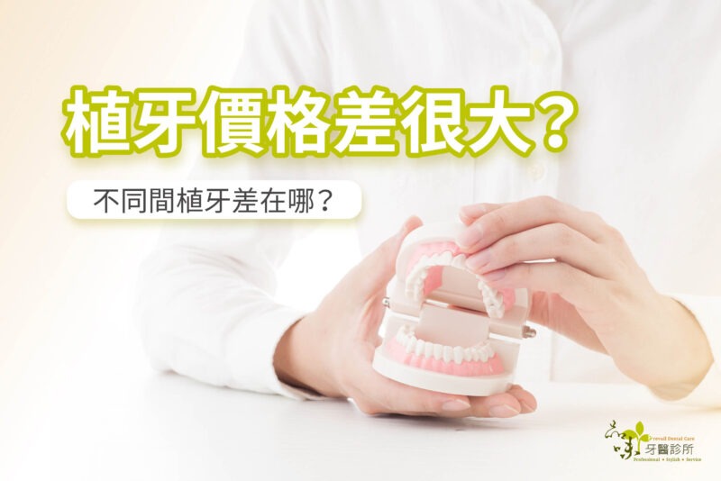 【品味牙醫】不同間植牙有什麼差？為什麼植牙價格落差大？