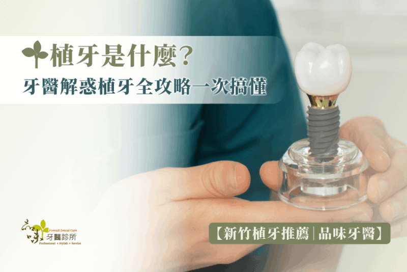 植牙是什麼？牙醫解惑植牙全攻略一次搞懂【新竹植牙推薦｜品味牙醫】