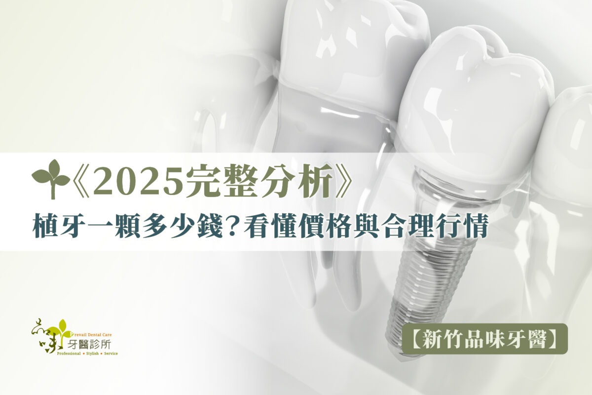 《2025完整分析》植牙一顆多少錢？看懂價格與合理行情【新竹品味牙醫】