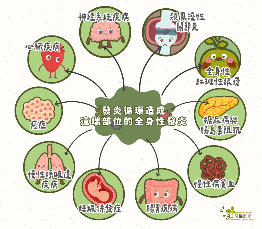 身體的發炎循環會造成遠端部位多種全身性發炎疾病