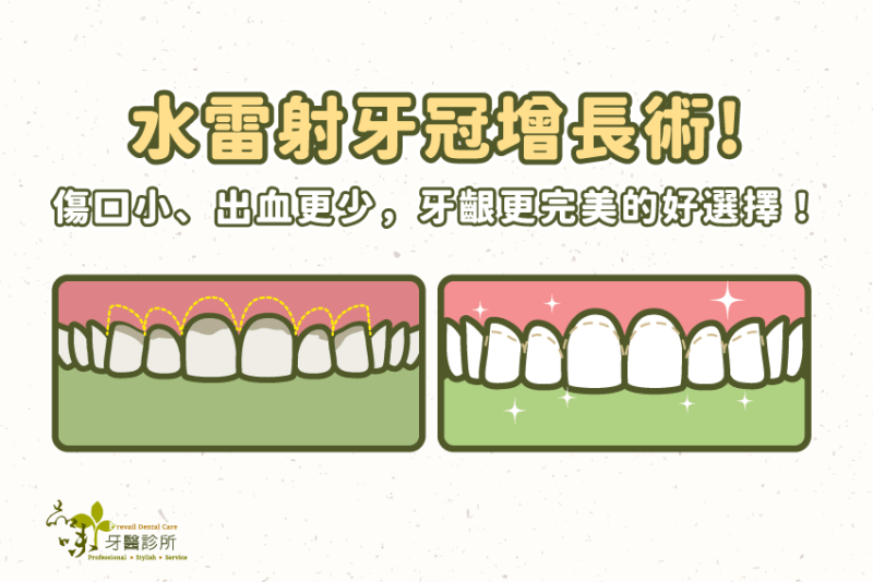 受保護的內容: 「水雷射」前牙牙冠增長術！傷口更小效果更好的最佳工具